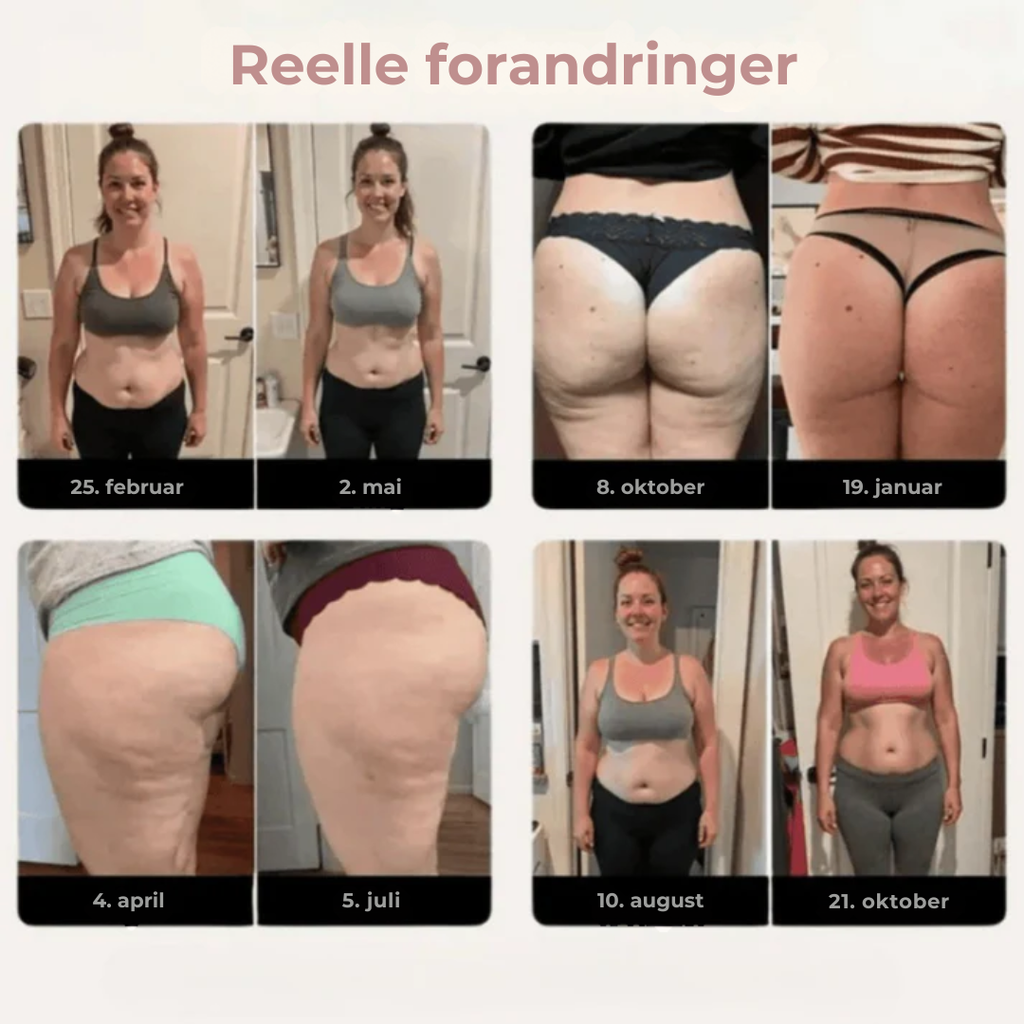 SculptWear™ | Leggings, der aktivt bekæmper cellulite