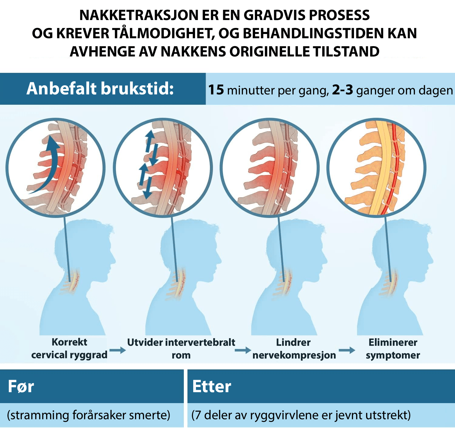 CERVIFLEX Nakkestrekker - NordHjem