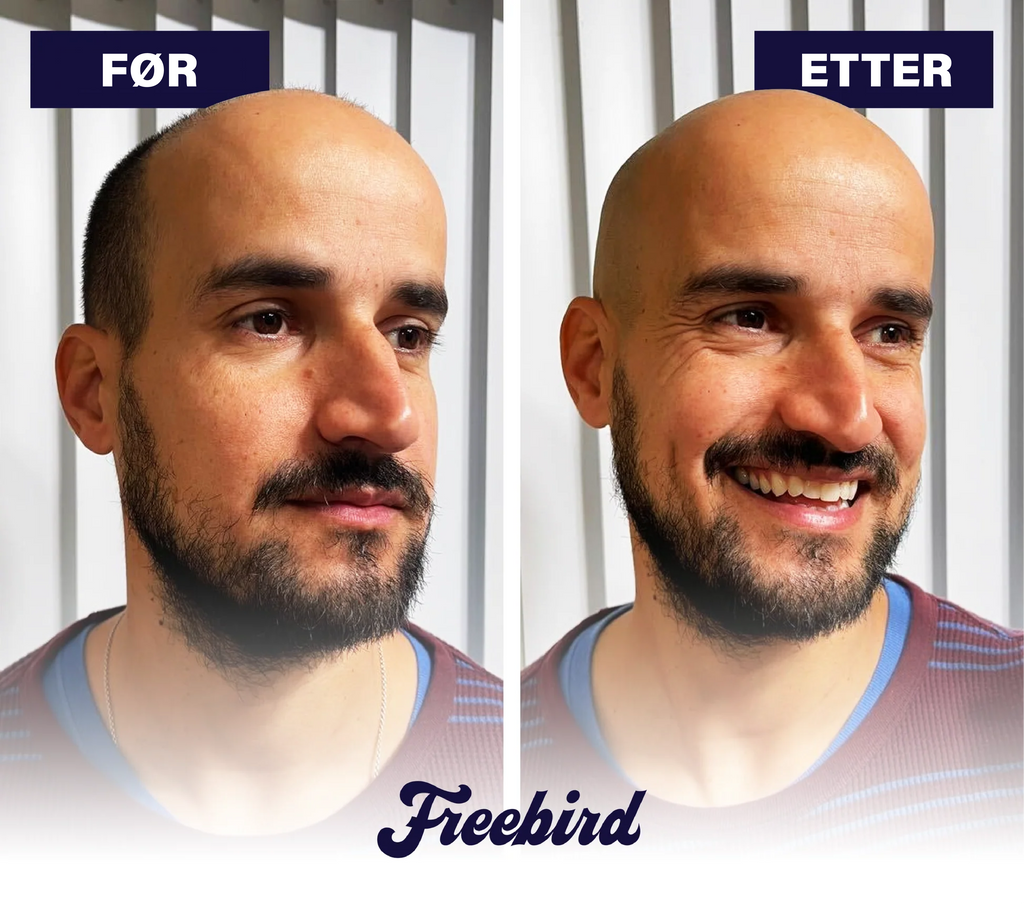 FlexSeries® Pro: Hodebarbering alt - i - ett sett - NordHjem
