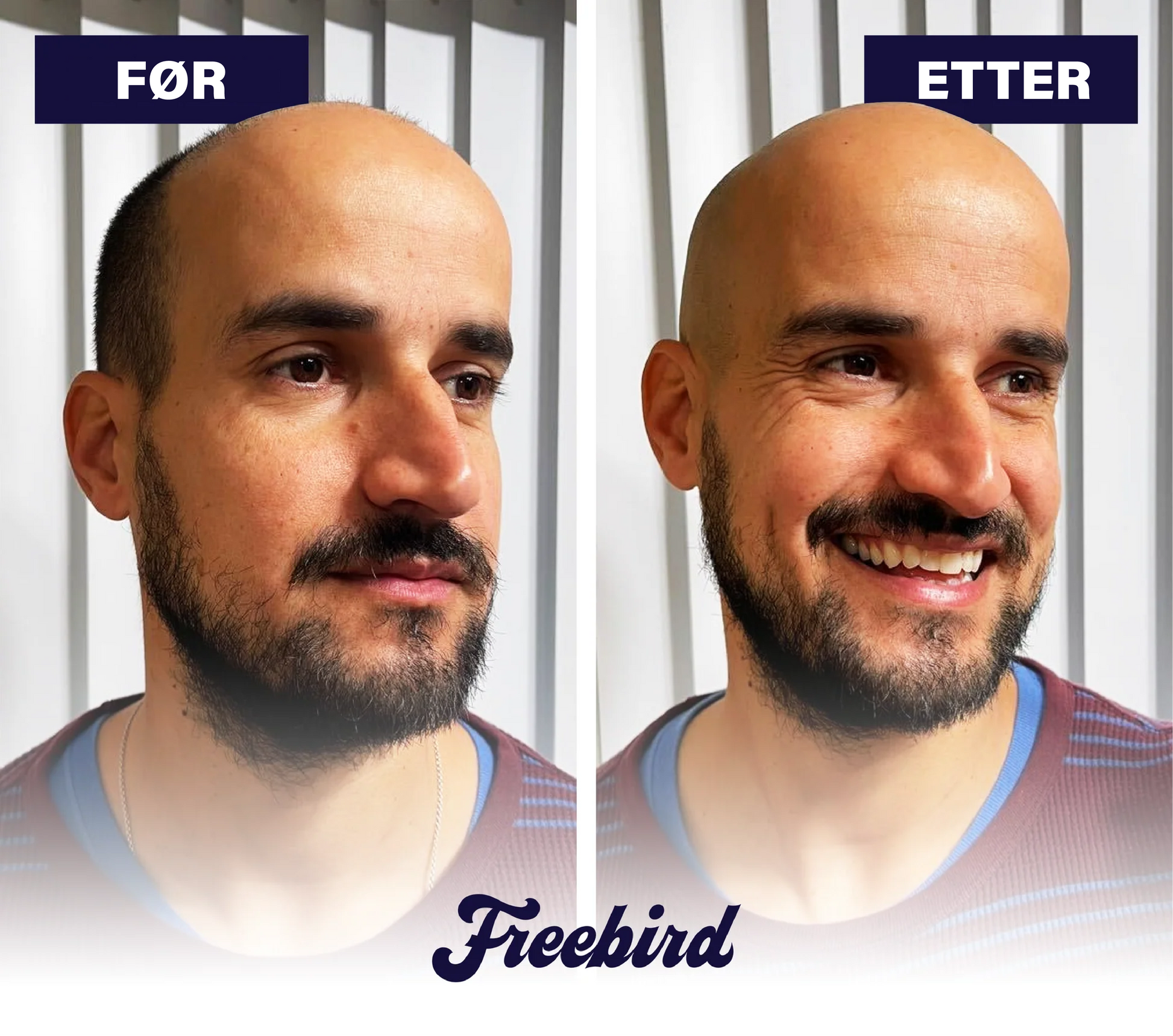 FlexSeries® Pro: Hodebarbering alt - i - ett sett - NordHjem