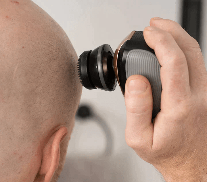 FlexSeries® Pro: Hodebarbering alt - i - ett sett - NordHjem